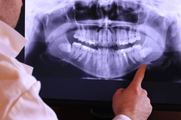 Best Chipped Tooth Repair Near Me  in Indian Trail, NC
